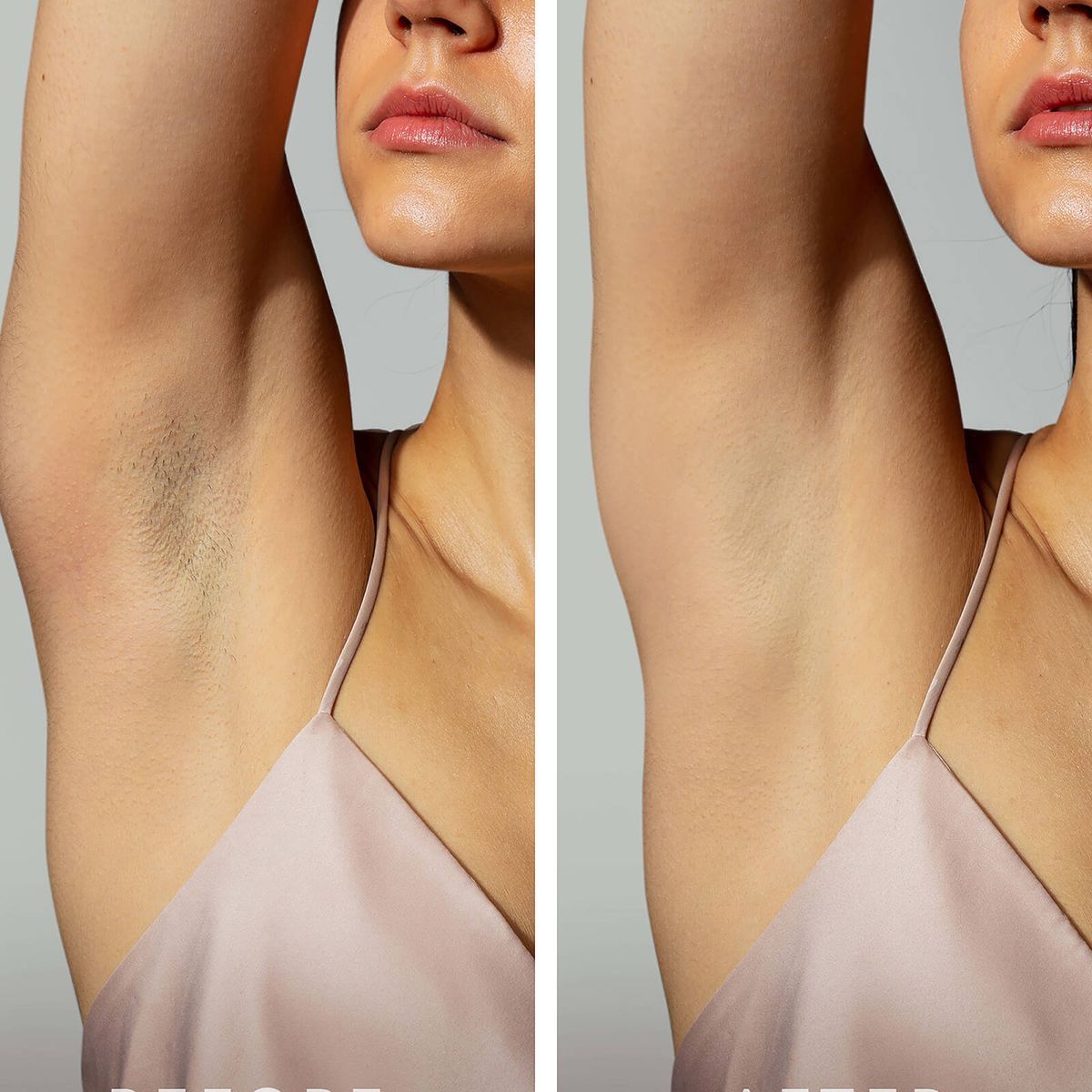Vellura Hair Removal Spray – Quick, Painless & Smooth (For Men & Women)