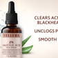 Vellura Salicylic Acid Serum – Acne Control & Pore Care
