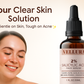 Vellura Salicylic Acid Serum – Acne Control & Pore Care